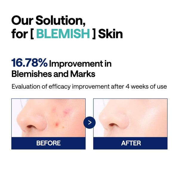 MEDIHEAL Madecassoside Toner Pads for Blemishes and Uneven Skin Tone - Vegan Gauze, 100 Pads