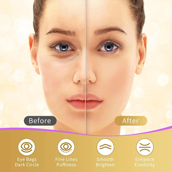 24k Gold Under Eye Patches, 40 Pairs Eye Mask for Dark Circles, Puffy Eyes