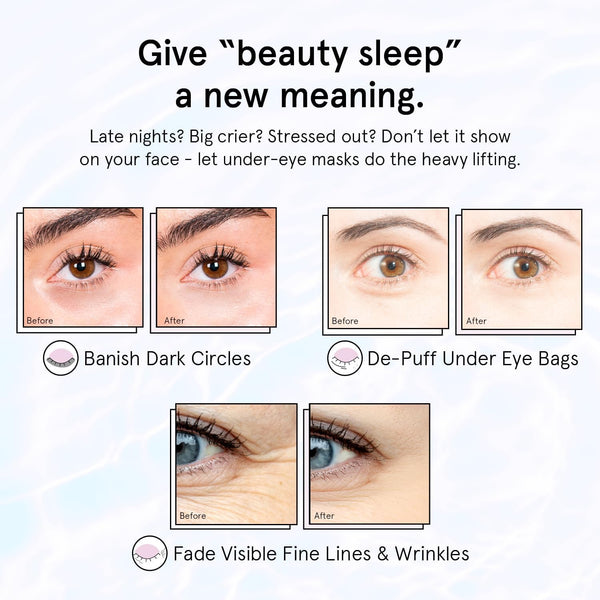 grace & stella Retinol Under Eye Patches for Puffy Eyes & Dark Circles - Restoring Gel Under Eye Masks with Hyaluronic Acid - Purple, 24 Pairs for Women
