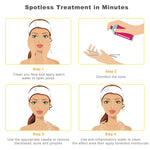 boxoyx 10 pcs pimple remover comedone extractor kit with box for quick and easy removal