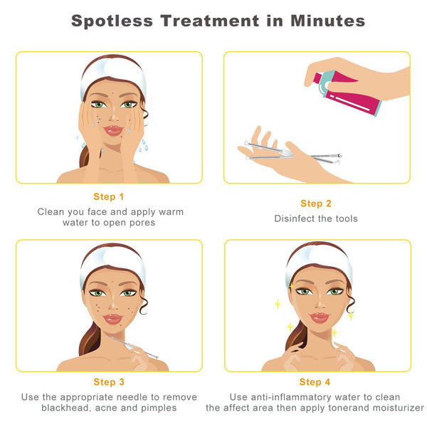 boxoyx 10 pcs pimple remover comedone extractor kit with box for quick and easy removal