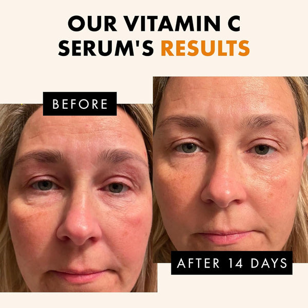 eclat skincare vitamin c serum 1 fl oz face care with hyaluronic acid and ferulic acid