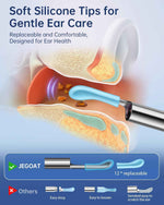 Jegoat Ear Wax Removal, Ear Wax Removal Tool Camera with 1296P HD Camera and 6 LED Lights, Ear Cleaner with 10 Ear Pick, Upgraded Ear Wax Removal Kit for iOS and Android, Black