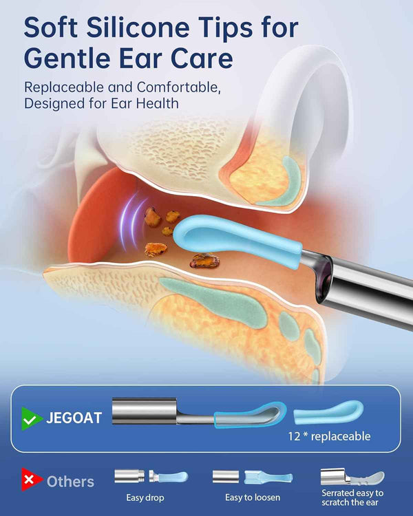 Jegoat ear wax removal kit with 1296p hd camera, 6 led lights and 10 ear pick for ios and android black