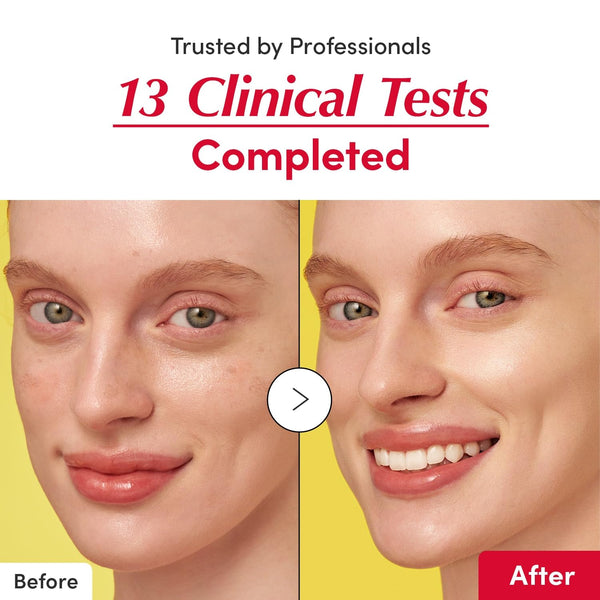 Vitaqueen Vitamin C Serum with Niacinamide and Ceramide, 1.01oz / 30ml, Brightening and Hydrating Face Serum