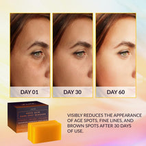valitic kojic acid dark spot remover soap bars with vitamin c and turmeric for skin care (2 pack)
