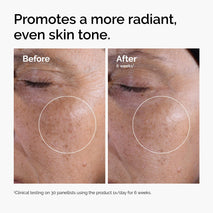 the ordinary glycolic acid 7% exfoliating toner, brightening and smoothing daily toner for uneven skin tone
