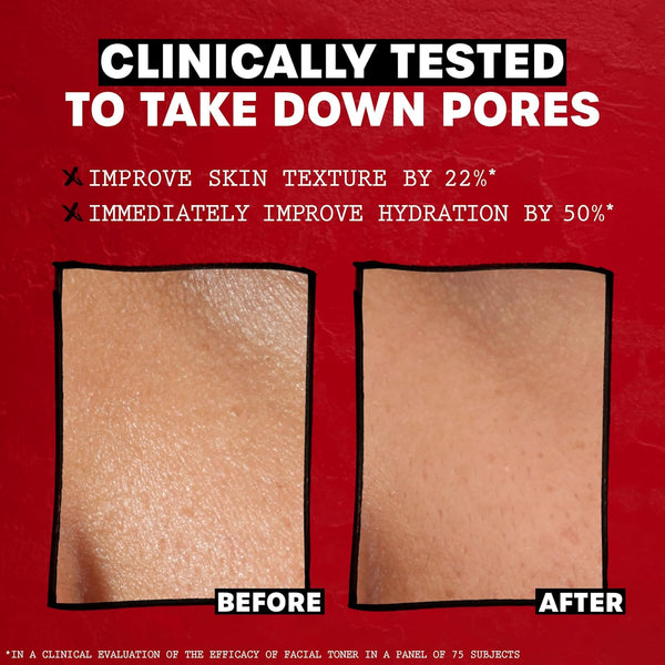 thayers alcohol-free rose petal witch hazel facial toner 12oz soothing hydrating refreshing toner for all skin types