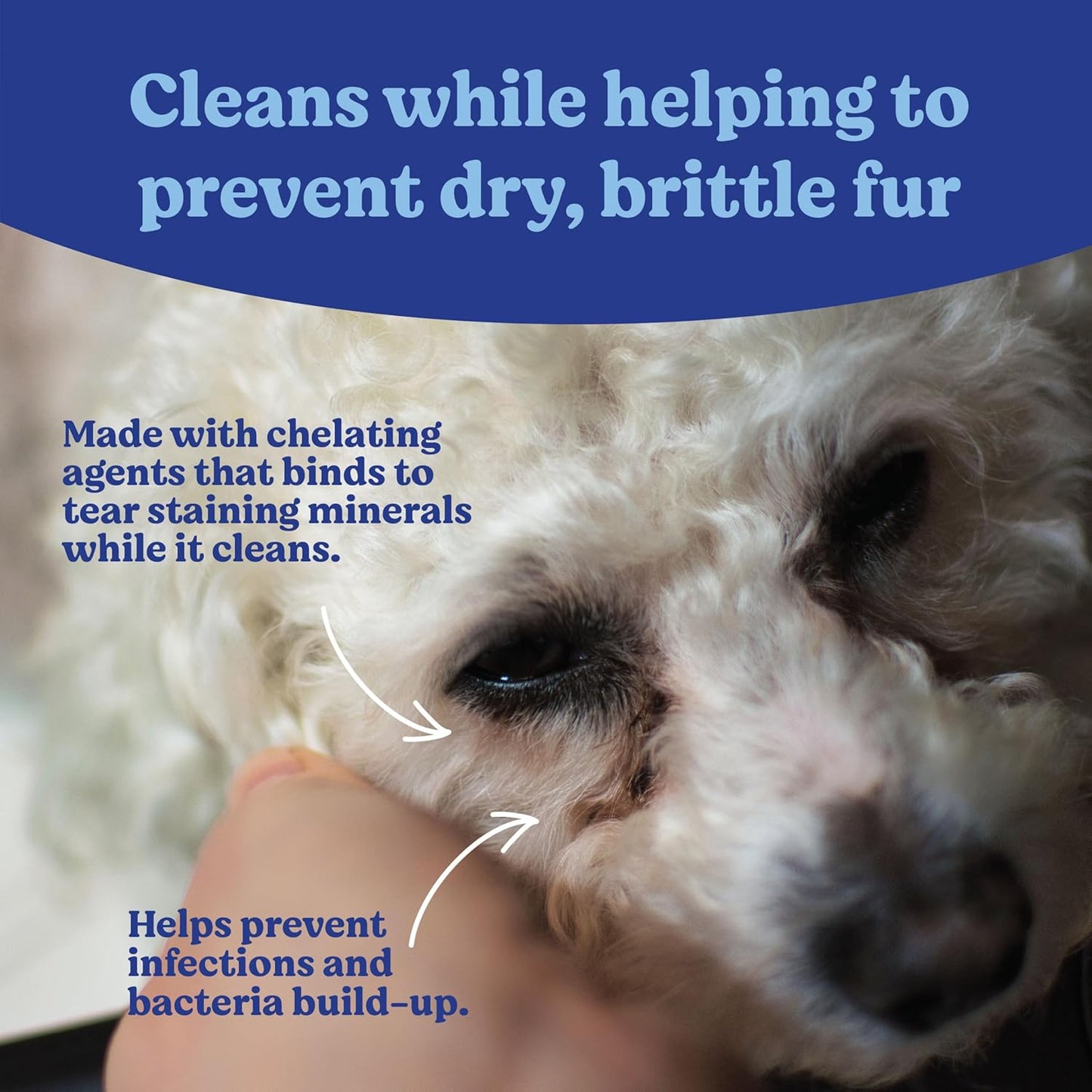 Angel's Eyes Gentle Tear Stain Wipes for Dogs and Cats - 100 Ct - Presoaked Textured (AEGTSW100)