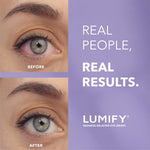 Lumify eye drops for red eyes relief 0.08 fl oz 2.5ml fda approved